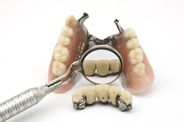 broken-denture-repair
